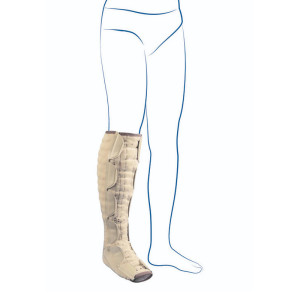 Гольф Thuasne MOBIDERM при лімфедемі